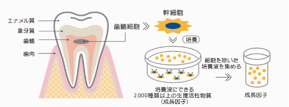 図２：ヒト乳歯由来歯髄幹細胞培養上清液の精製方法イメージ図