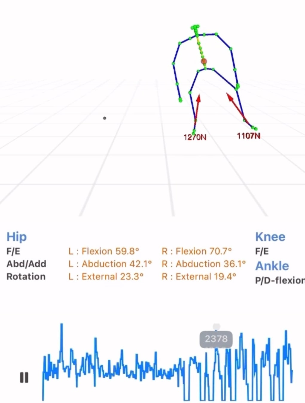 ブレイキン・オリンピック初代女王・B-Girl AMI 選手&横浜出身のB-Girl Nanoha 選手によるトークセッションを横浜市役所アトリウムで開催!【8月14日・申込不要】